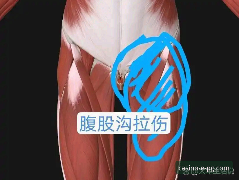 PG电子赢钱技巧 瑞典中场贝里瓦尔世预赛带伤作战最新动态:手术后三天韧带恢复,用腹股沟封堵射门